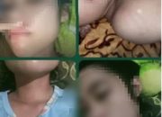 Polsek tanjung bintang terkesan lamban dalam penanganan kasus KDRT yang di alami seorang ibu rumah tangga serta anak nya.